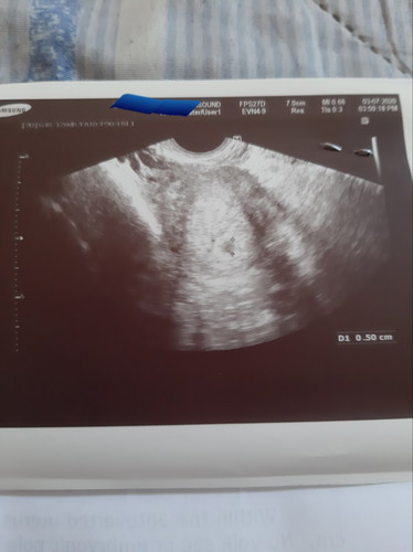 Soon to be mama na ba?
