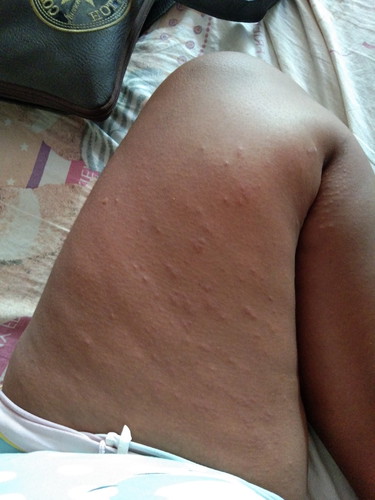 มีใครเคยเป็นบ้าง