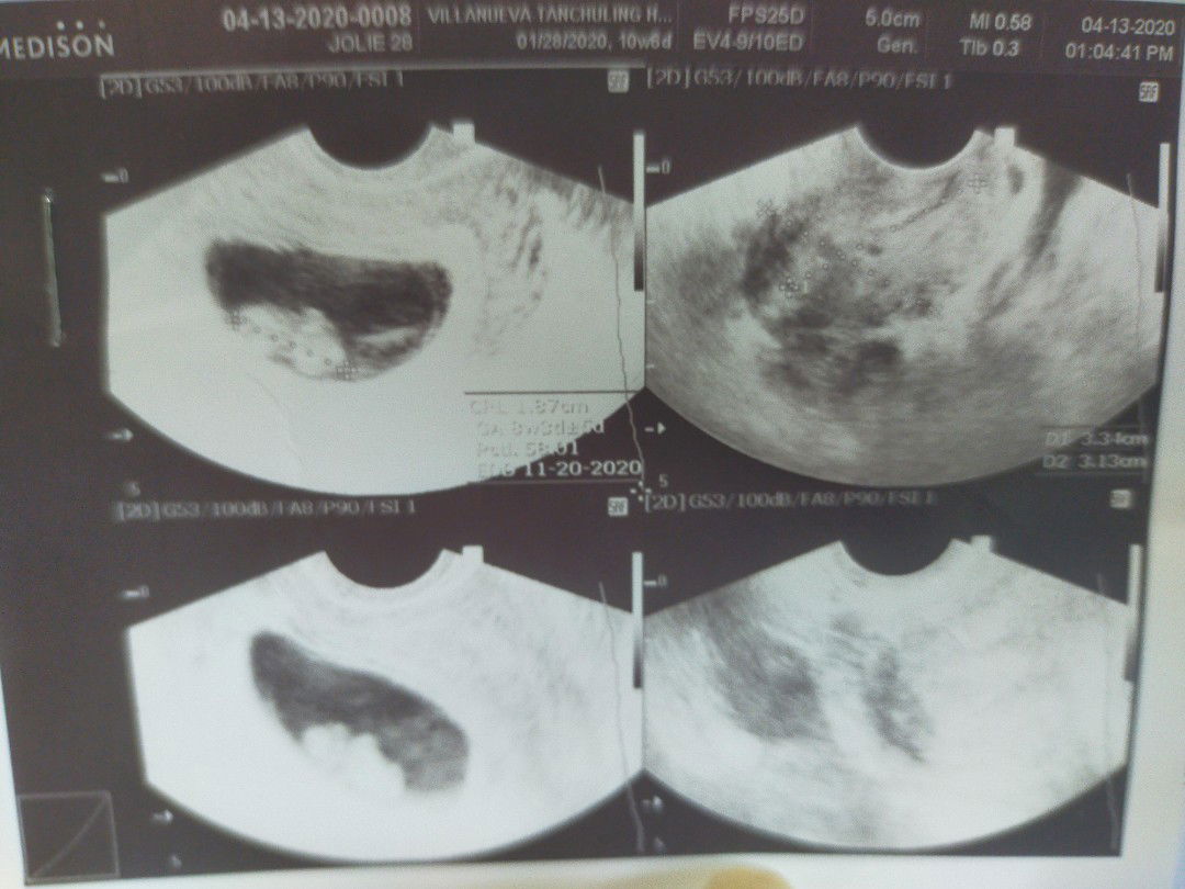 Joie Syrene Gastilo profile icon