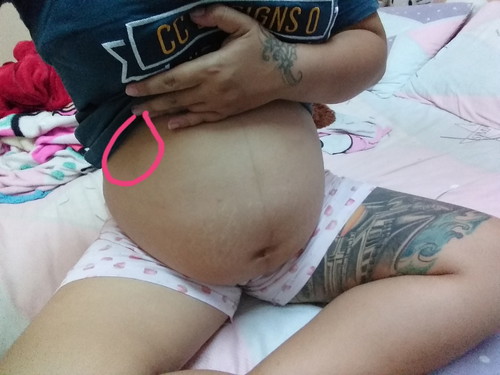 แม่ตั้งครรค์