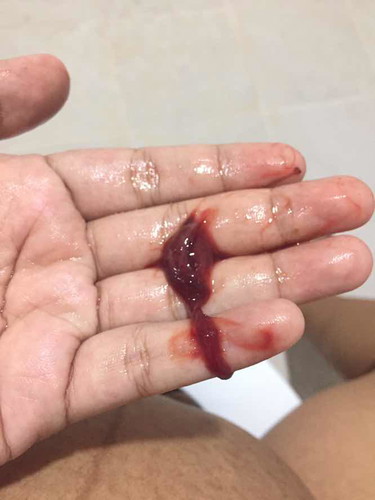 คุณแม่คนไหนเป็นบ้าง