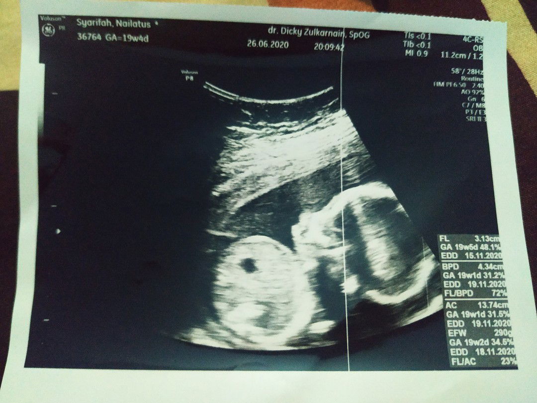 USIA KEHAMILAN 19 WEEK