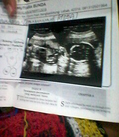 kehamilan tremester ke 2