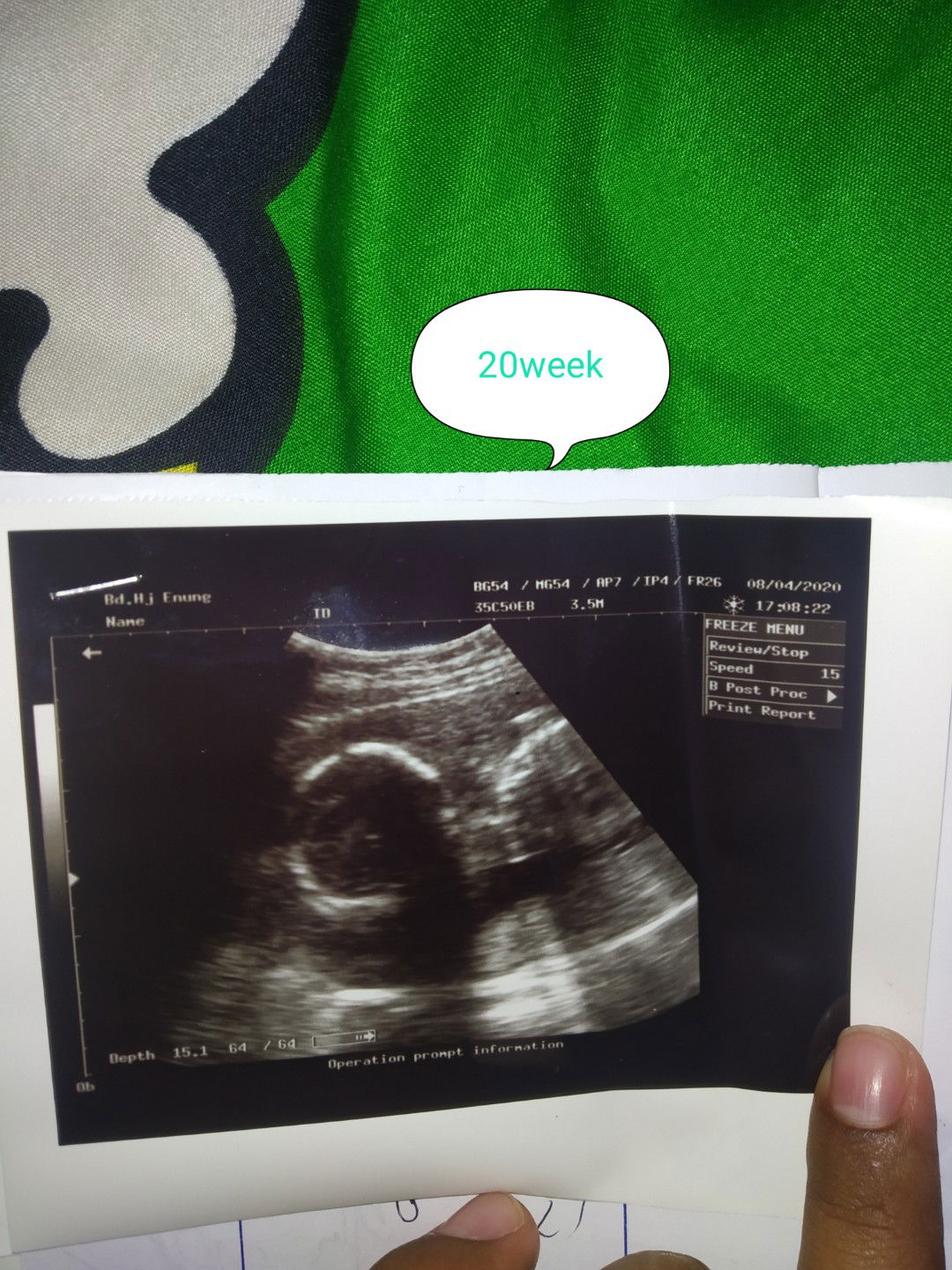 Hai bunda ini hsil priksa aku kmrin , kta bidan dedek sehat jantung sehat dedek aktif bgt di dlem perut ? perkiraan bidn HPL agustus ,, apakah ad bunda""dsni ad yg sma ,, ohh iya emg ibu hmil gk boleh mkan sate ya bun