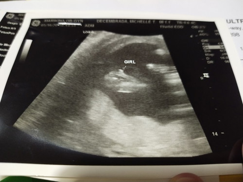 my baby girl at 18 weeks..