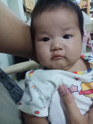 ลูกติดขวด