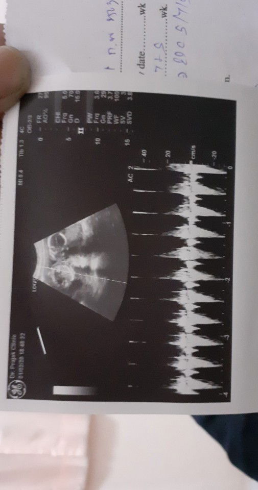 ออกัส profile icon