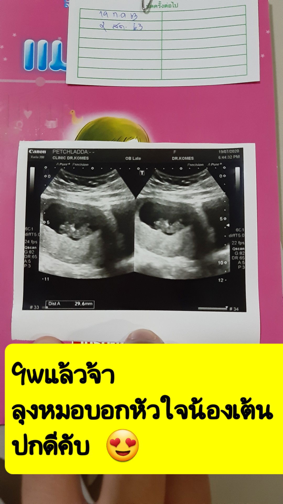 ขอความคิดเห็นค่ะ