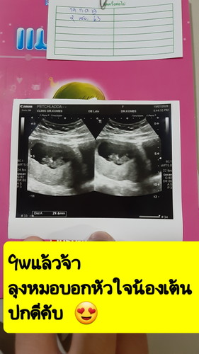 ขอความคิดเห็นค่ะ