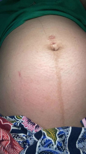 แม่ๆคนไหนพอจะมีครีมดีๆแนะนำไหมค่ะ