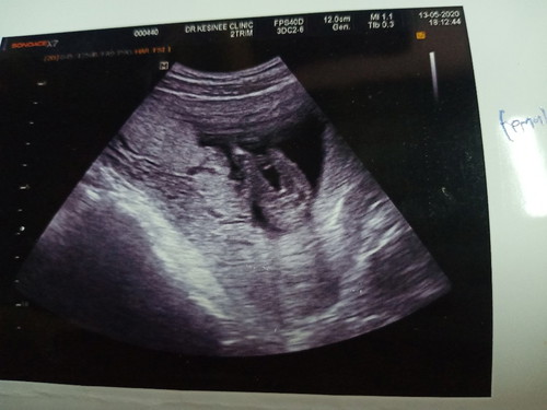 16+1W กำหนดคลอด2พฤศจิกาค่ะ ผู้หญิงค่ะ