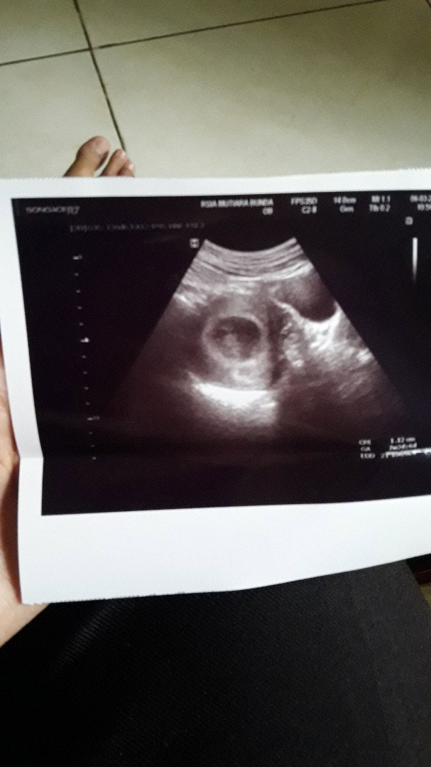 ulfah ratna profile icon