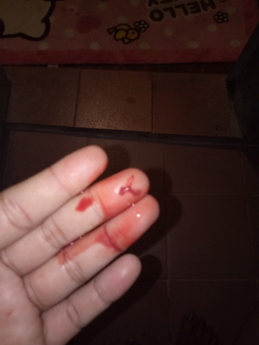 ask lng po 36weeks kuna today