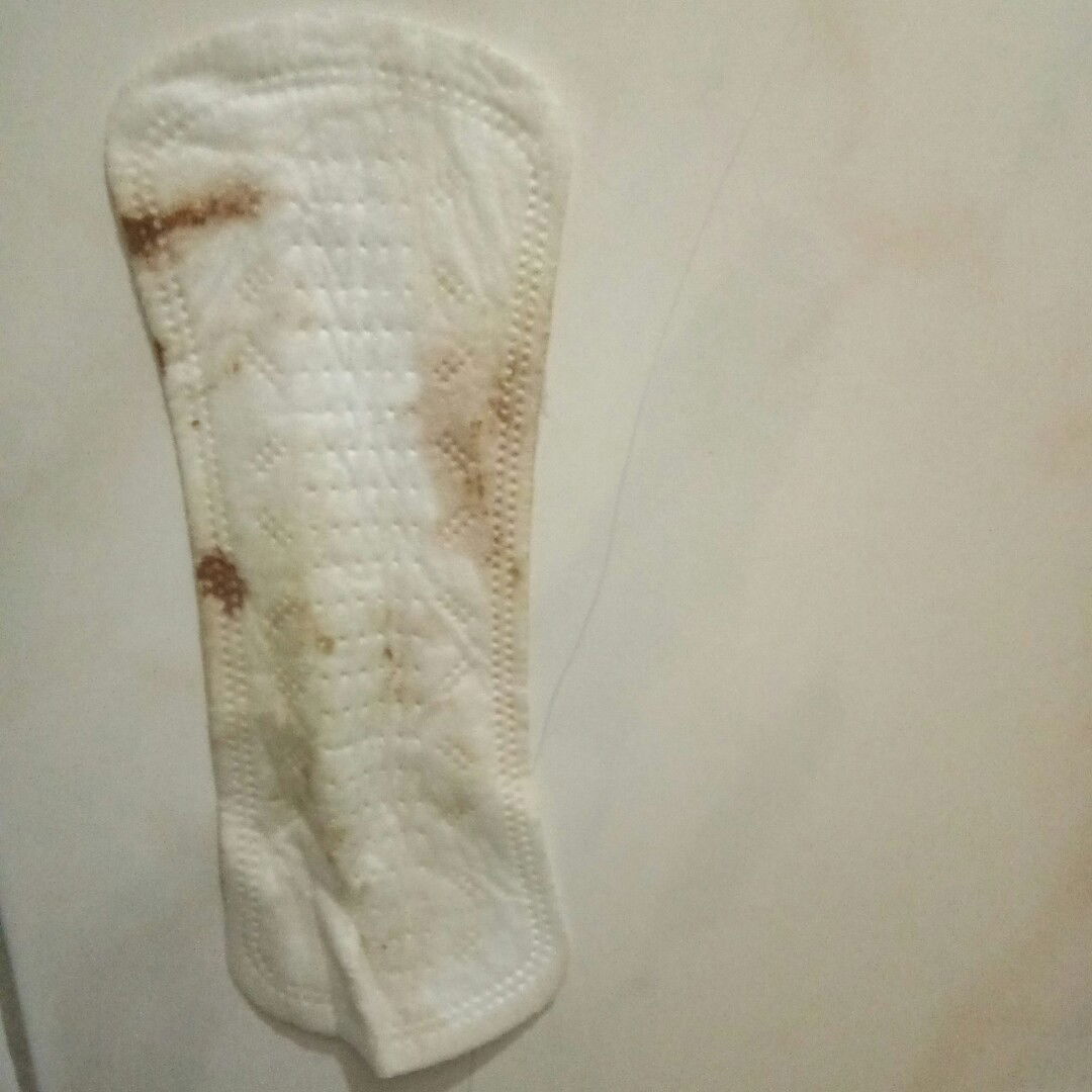 Brown discharge on 12 weeks,  is it normal?