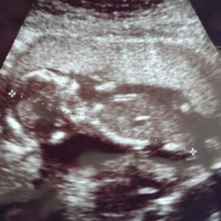 15wk