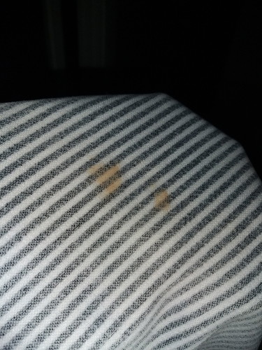 36 วีค สงสัย ค่ะ (ขนาดท้อง3แล้วยังสงสัยอยู่)?