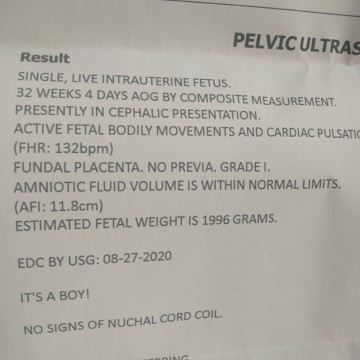 ultrasound