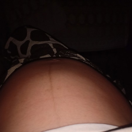 Masakit na buto sa pempem