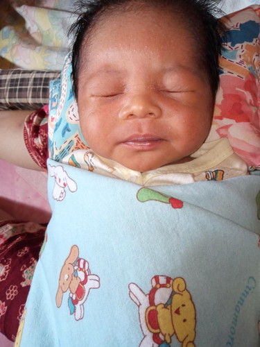 bayi baru lahir bisa terkena filek