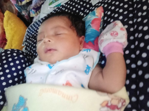 cara mengatasi filek pada bayi