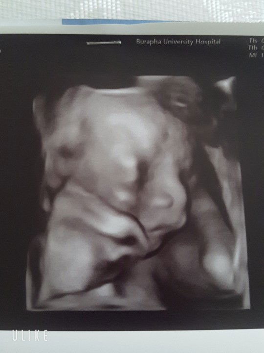 ผู้ชายคับป๋ม