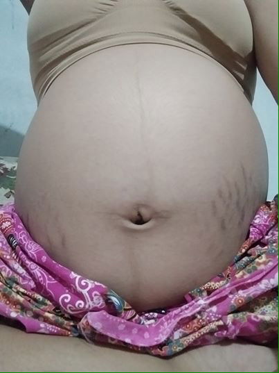 ขอความเห็นจากแม่ๆหน่อยค่ะ