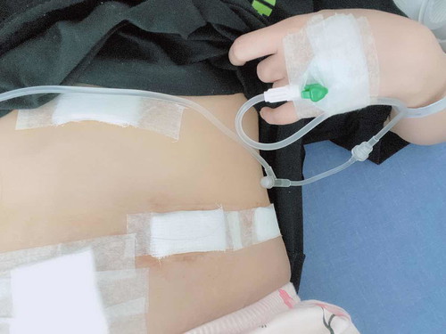 Dapat ba ko matakot? 21w3d pregnant