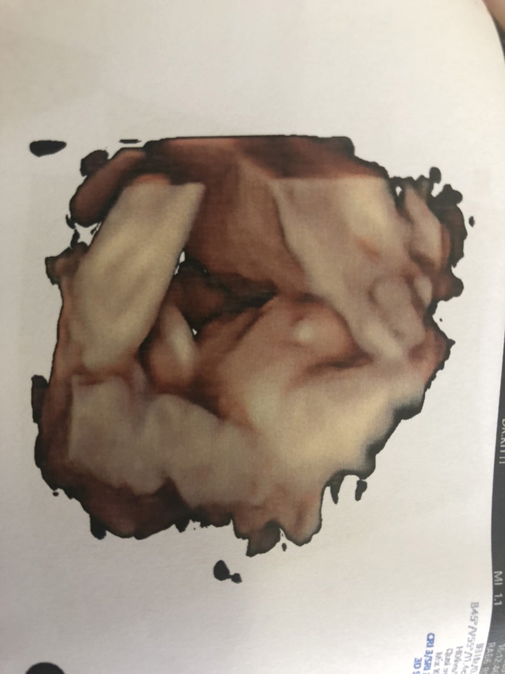 Post reply image