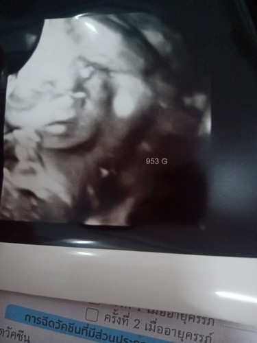 25wแล้วค๊าบทูลหัวของแม่👶😁