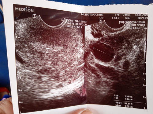 สรุปค่ะ ฮอโมนสวิง