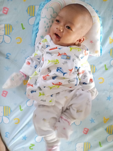 น้องแฝด