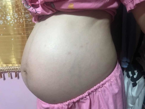 32+3 w ท้องเล็กไปไหมคะ