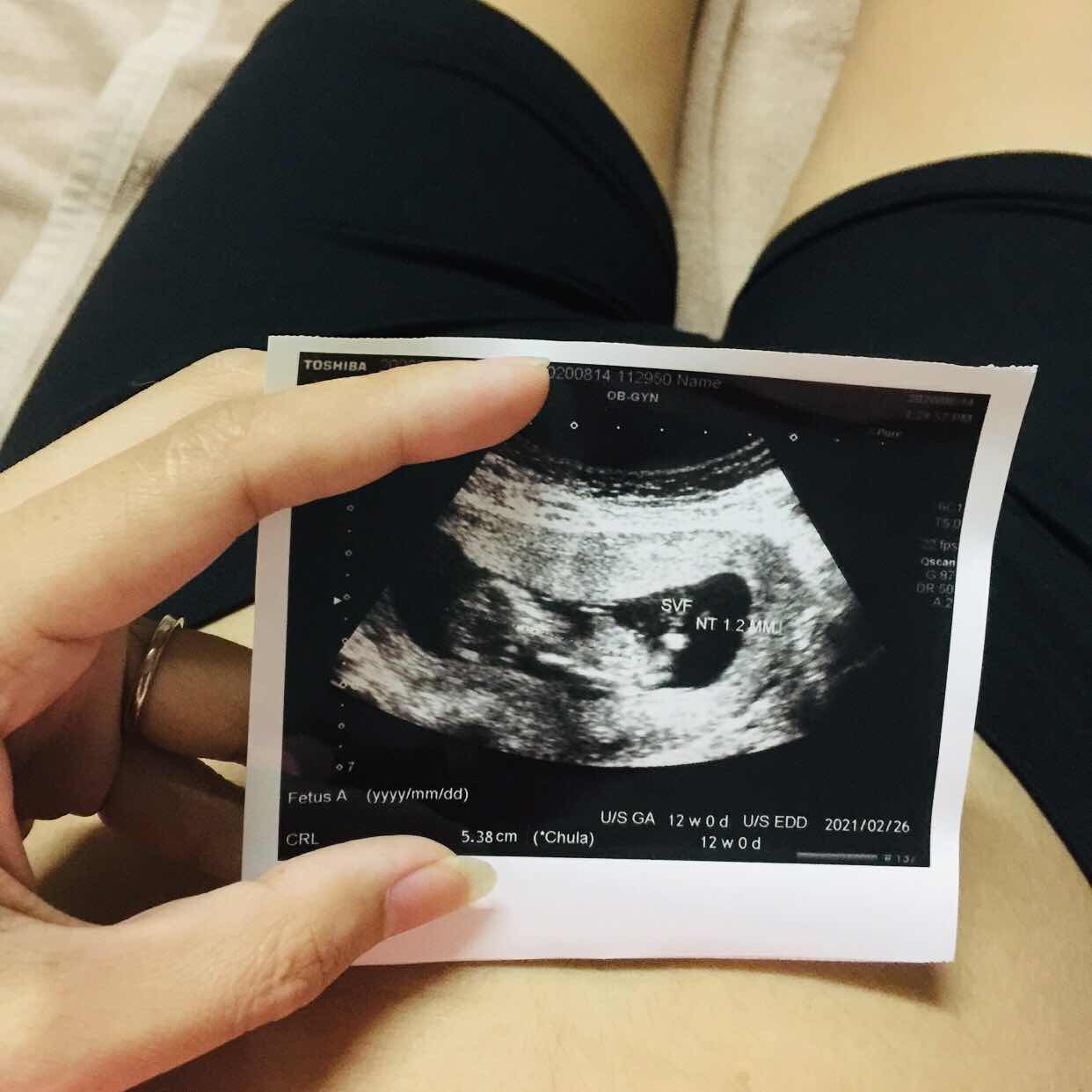 mei.saya profile icon