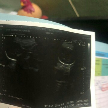 ช่วยดูเพศหน่อยค่ะ