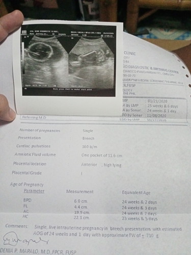 ultrasound