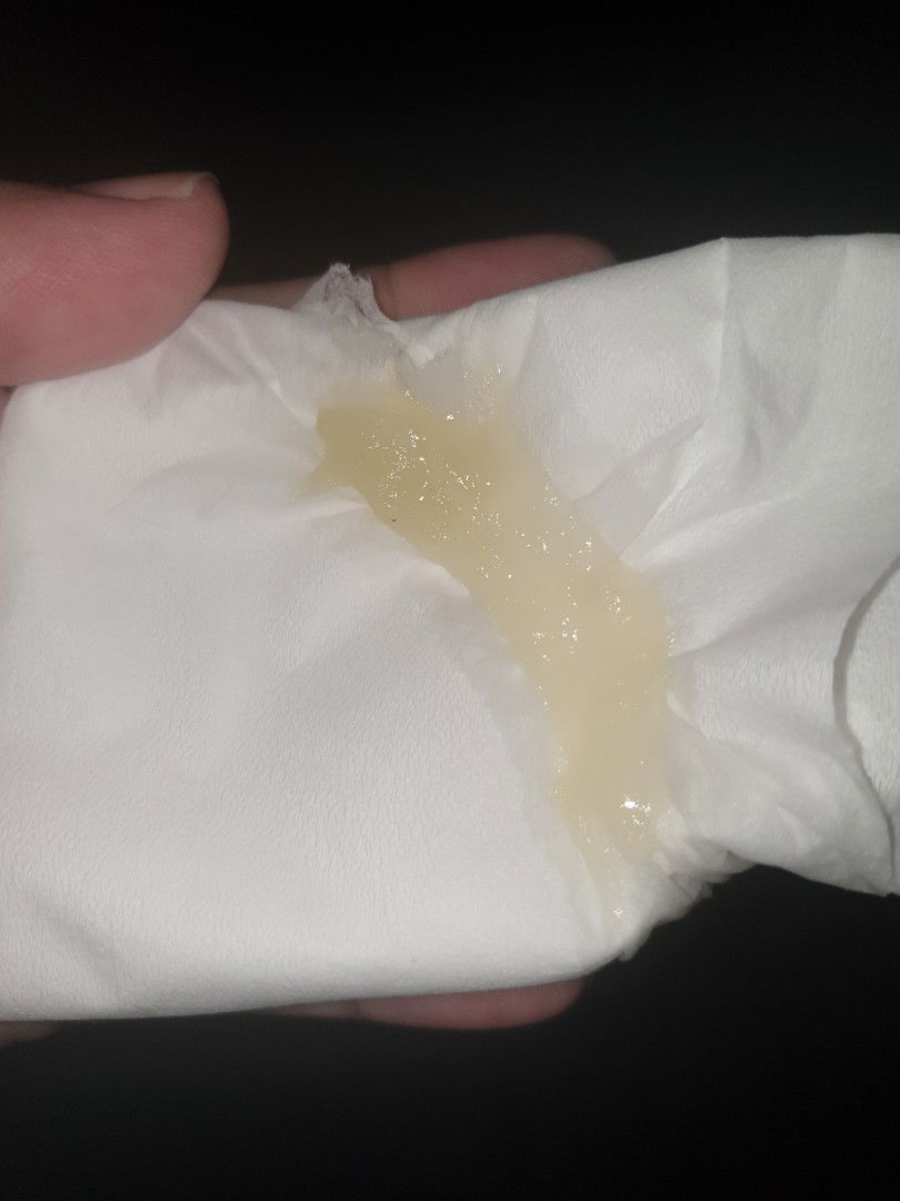 HPL juli keluar lendir