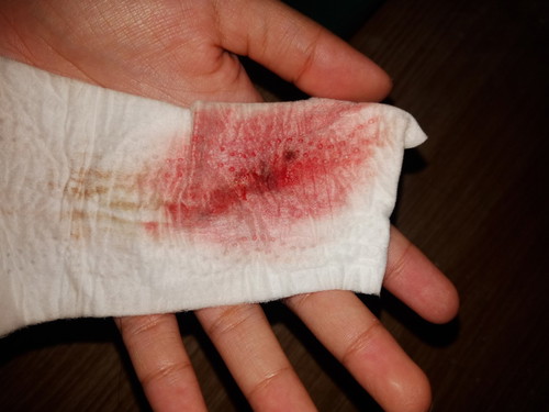 หนูจะท้องไหม