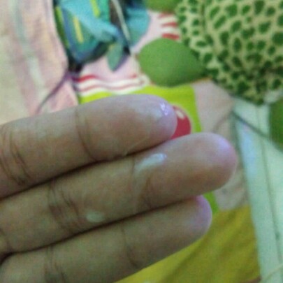 มูกหรือตกขาว?