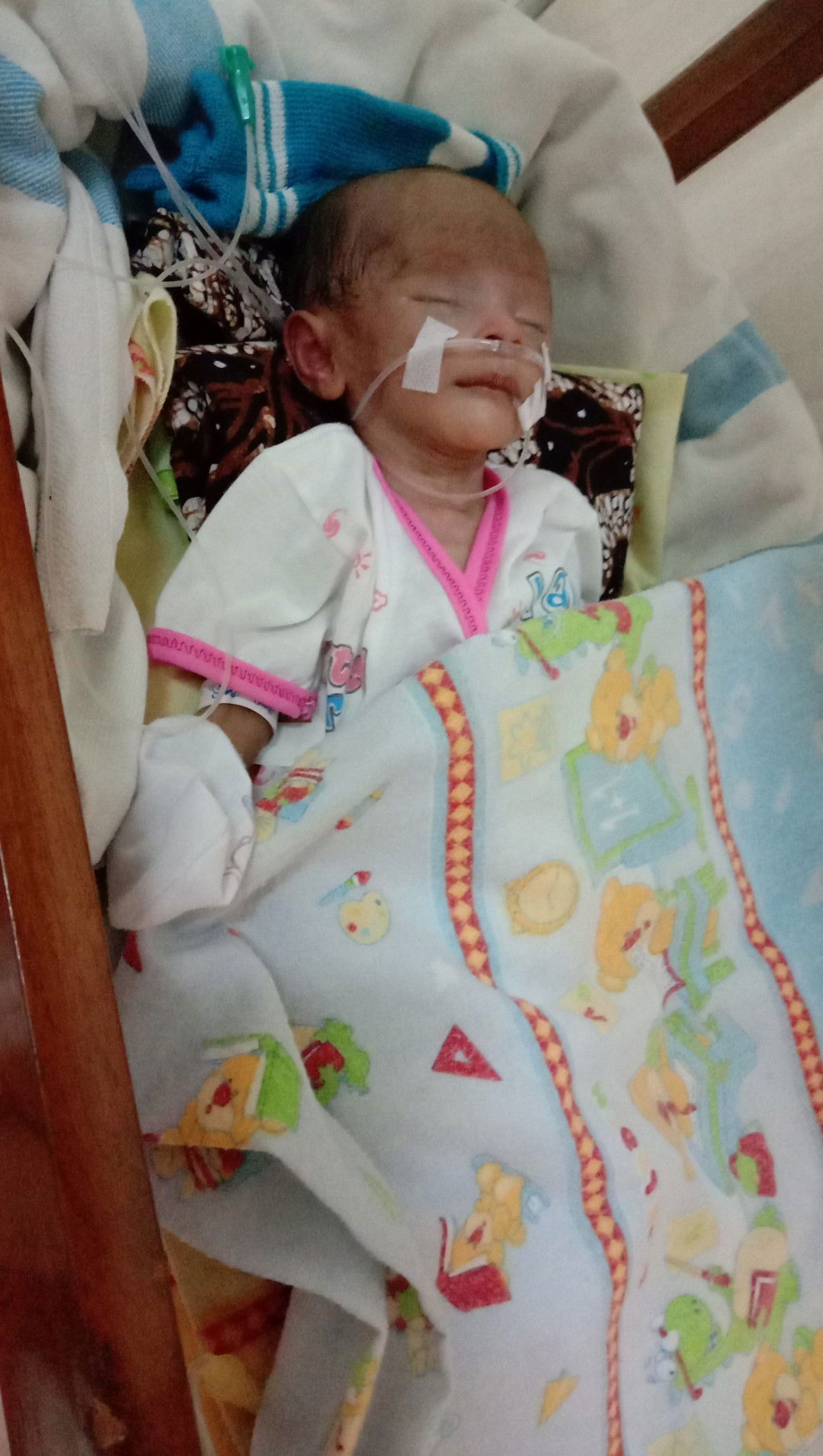 Bayiku pejuang Hidrosefalus