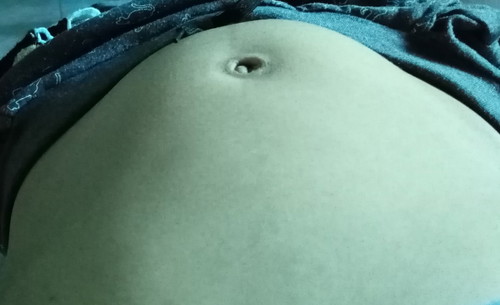 อยากรุ้ว่าทำไมท้องถึงเปนแบบนี้