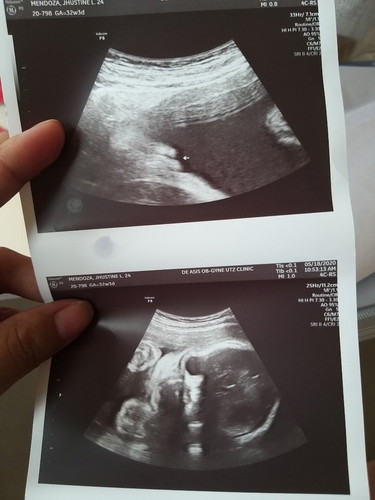 How to read an Ultrasound
