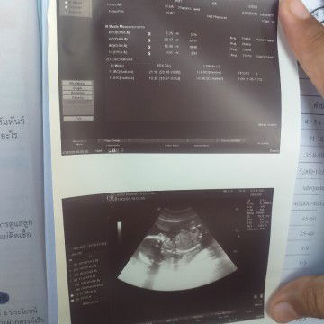 อยากทราบว่ามีนํ้าหนักของลุกไหมค่ะคุนแม่ท่านไหนรุ้ช่วยบอกหน่อยค่ะ