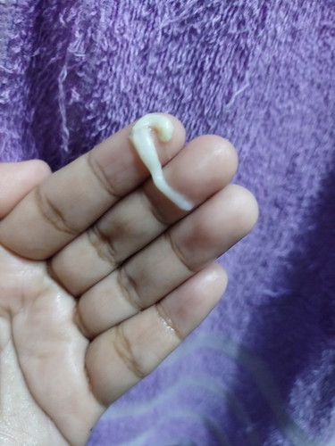 keputihan
