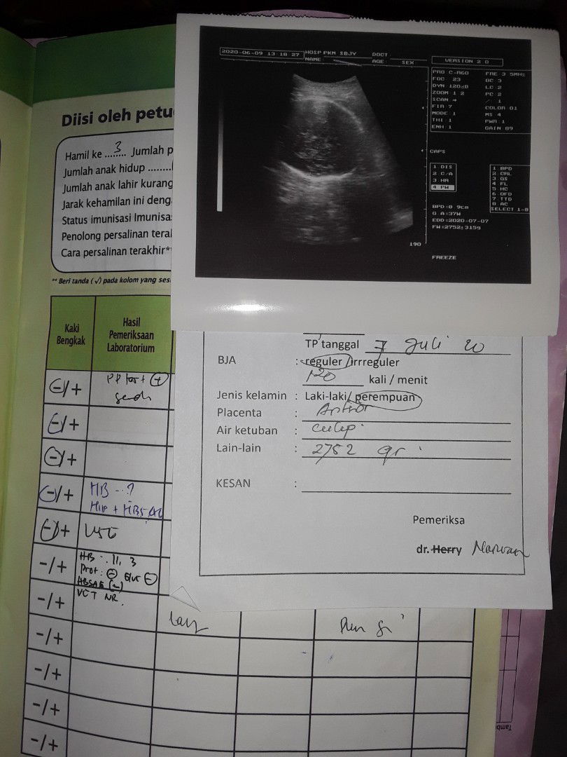 menantikan kehadiran sang buah hati