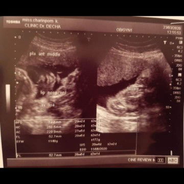 Charinporn Khawjan profile icon