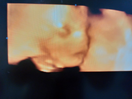 ญ.หรือ ช.??