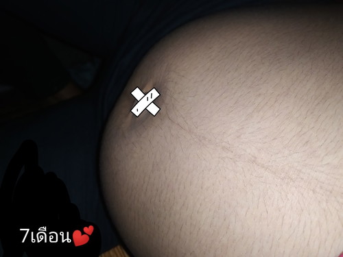 ท้องเล็ก