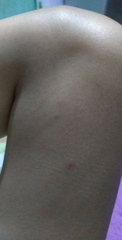 rashes but not itchy 24weeks preggy