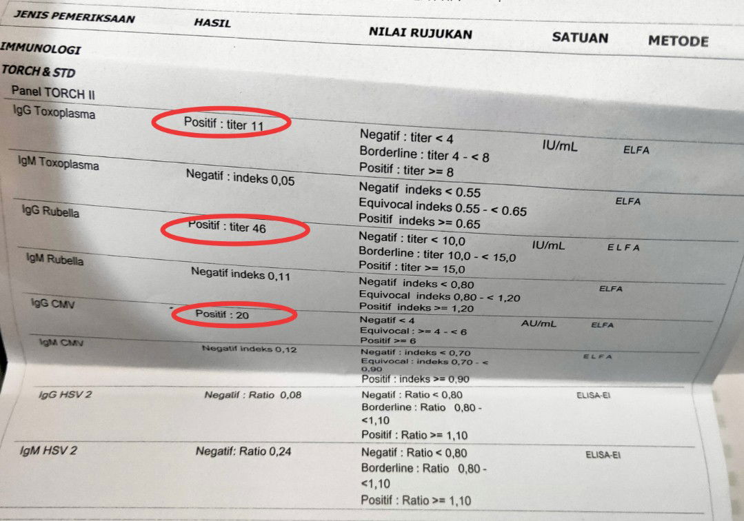 hasil lab igg toxoplasm , rubela dan cmv positif