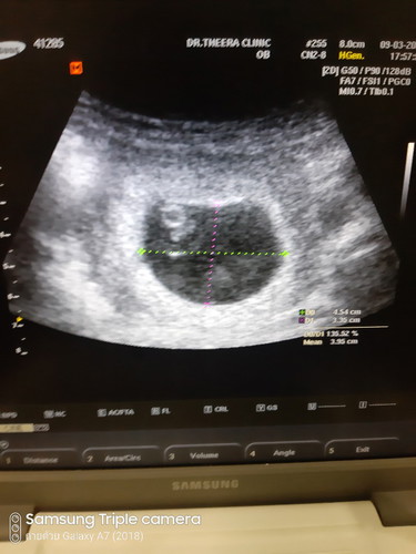 เรากำลังเสียเขาไป